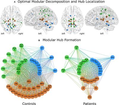 Functional Neural Networks in Writer's Cramp as Determined by Graph-Theoretical Analysis